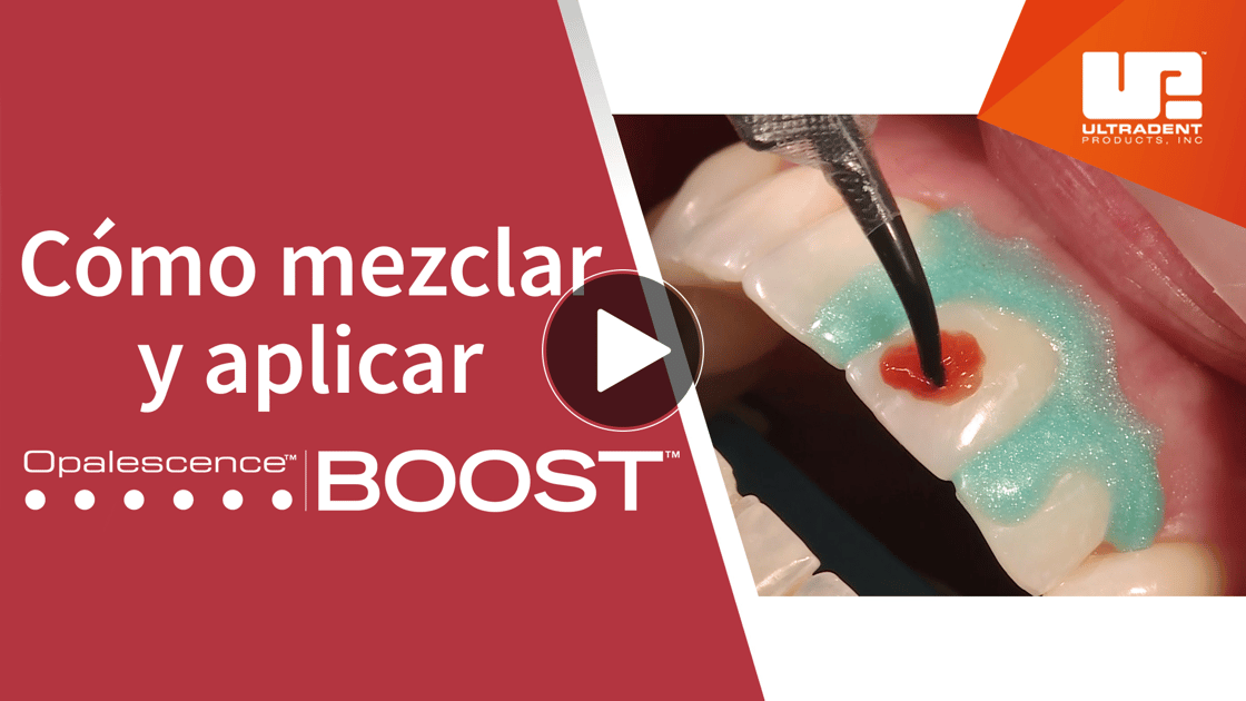 Nuevo video Boost